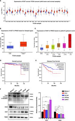 Inhibition of O-GlcNAc transferase sensitizes prostate cancer cells to docetaxel